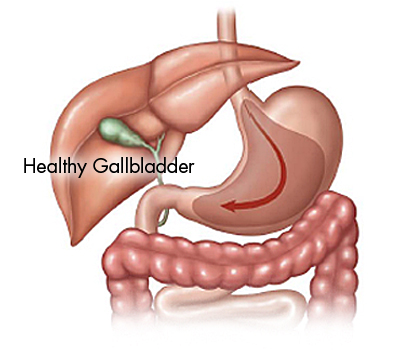 Loop Duodenal Switch