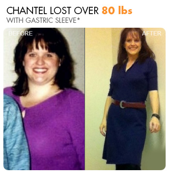 Transformation Story: Chantel
