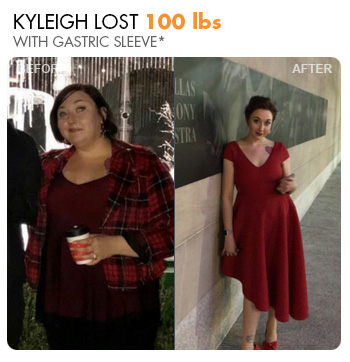 Transformation Story: Kyleigh