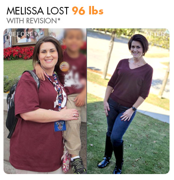 Transformation Stories: Melissa