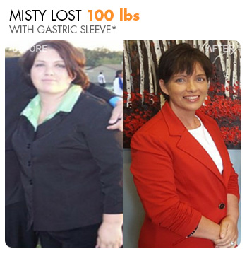 Transformation – Misty’s Story