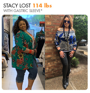 Transformation Story: Stacy