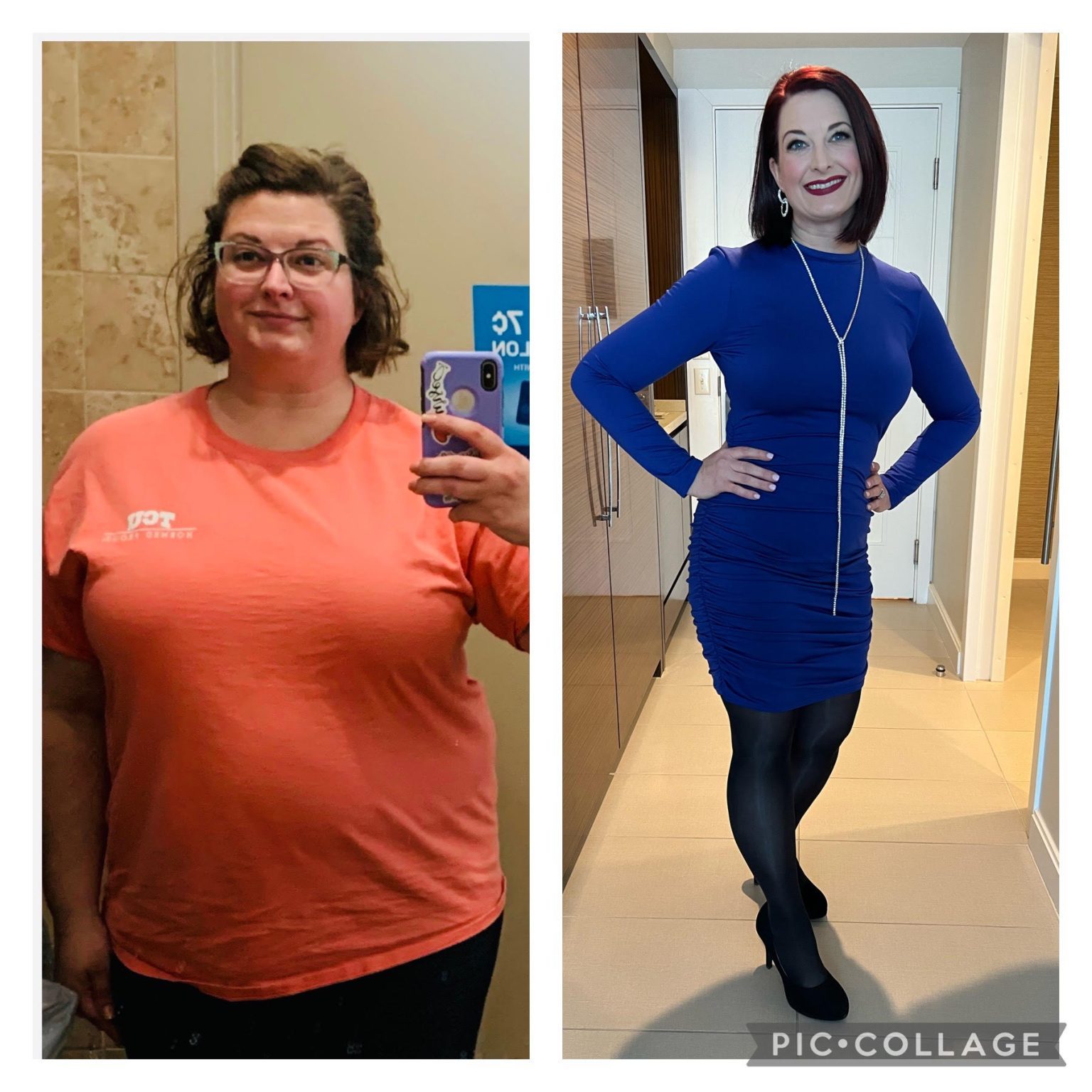 Transformation Stories Casi Texas Bariatric Weight Loss Surgery